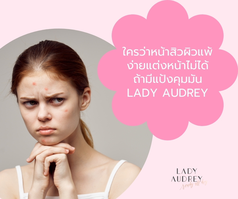 ใครว่าหน้าสิวผิวแพ้ง่ายแต่งหน้าไม่ได้ ถ้ามีแป้งคุมมัน Lady Audrey (1)